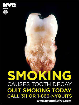 smoking effects on teeth. health effects of smoking