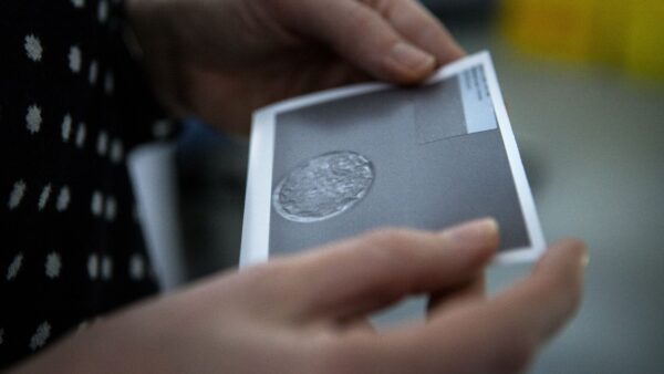 woman holding photo of frozen embryo